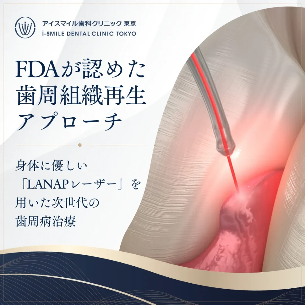 【2026年6月26日】FDAが認めた歯周組織再生アプローチ。身体に優しい「LANAPレーザー」を用いた次世代の歯周病治療