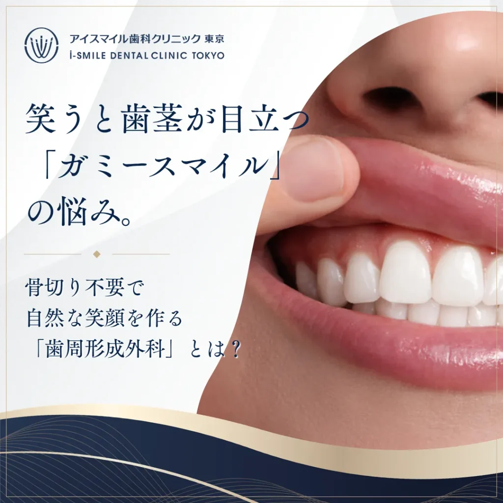【2026年8月21日】笑うと歯茎が目立つ「ガミースマイル」の悩み。骨切り不要で自然な笑顔を作る「歯周形成外科」とは？
